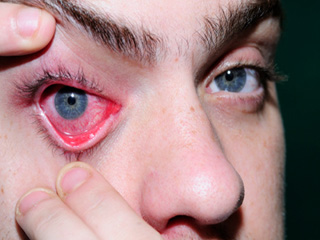 ग्लूकोमा से कैसे बचें 